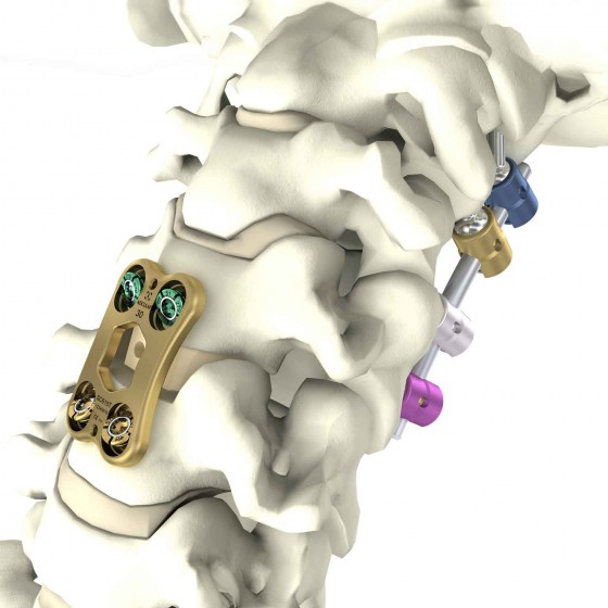 3D/Film - Animation - Medical Design - Aesculap - Spine Visuals - Beger Design - Wirbelsäulenimplantate