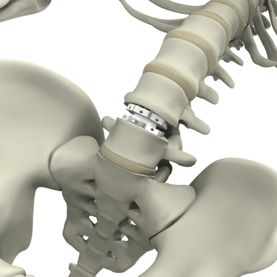 3D/Film - Animation - Medical Design - Aesculap - Spine Visuals - Beger Design - Wirbelsäulenimplantate